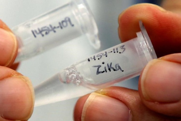 Deux modes de transmission du virus Zika de la mère à l’enfant Deux modes de transmission du virus Zika de la mère à l’enfant