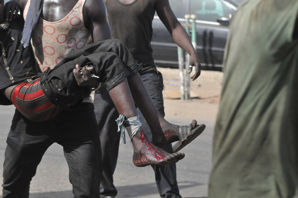 MARCHE DU 14 OCTOBRE : Les organisations de la société civile condamnent les violences exercées contre des citoyens MARCHE DU 14 OCTOBRE : Les organisations de la société civile condamnent les violences exercées contre des citoyens