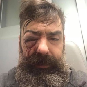 Jérôme Rodrigues, une des figures des "gilets jaunes" blessé à l'œil, l'IGPN saisie Jérôme Rodrigues, une des figures des "gilets jaunes" blessé à l'œil, l'IGPN saisie