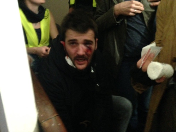 15h24 : Des blessés reçoivent les premiers sois dans l'escalier d'un immeuble riverain. Jessie dit avoir reçu un tir de LBD.