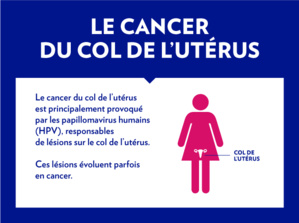 CANCER DU COL : Le plan stratégique de lutte permettra de connaître l’ampleur de la maladie CANCER DU COL : Le plan stratégique de lutte permettra de connaître l’ampleur de la maladie