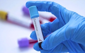 Coronavirus/Sénégal : 122 nouvelles contaminations, 2 nouveaux décès, 36 cas graves annoncés jeudi