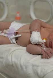 Séisme en Syrie: la petite miraculée de Jandairis