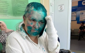 Russie - Une journaliste d’investigation passée à tabac en Tchétchénie Russie - Une journaliste d’investigation passée à tabac en Tchétchénie