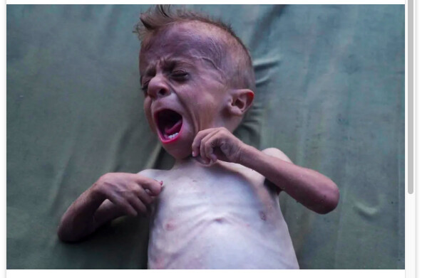 Dans le ghetto de Gaza, le génocide et la famine imposés par l'administration israélo-américaine restent de rigueur