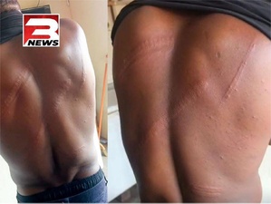 Les signes de l'agression contre le journaliste Salomon Kanaluwe par des officiers militaires ghanéens (Photo News3)