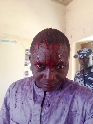 WAES condemns unprovoked assault on journalist Mohammed Adamu by Bauchi police WAES condemns unprovoked assault on journalist Mohammed Adamu by Bauchi police