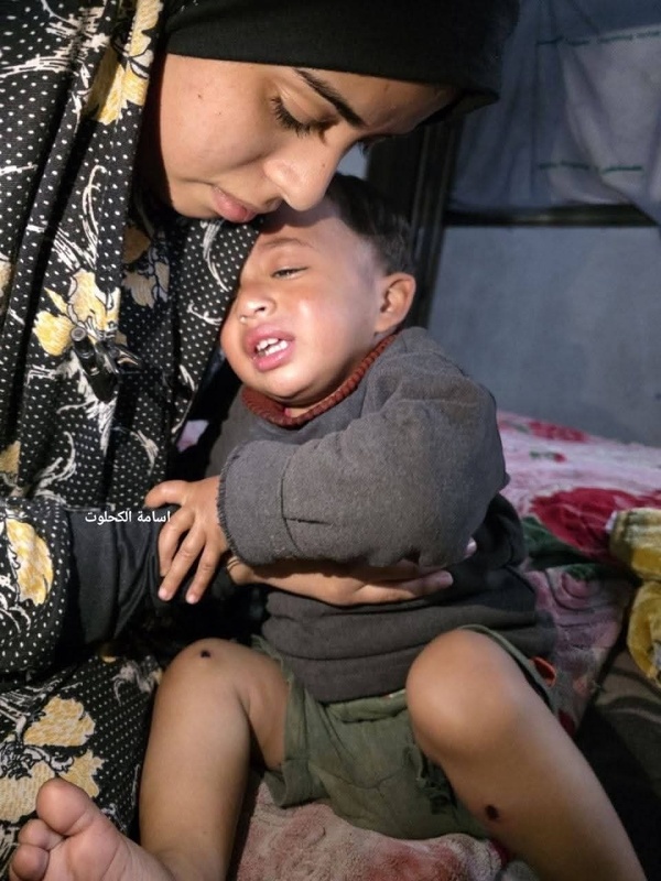 Karim, le bébé de 18 mois torturé par l'armée israélienne Karim, le bébé de 18 mois torturé par l'armée israélienne