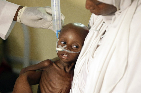 Des milliers d'enfants risquent de mourir de faim au Nigeria