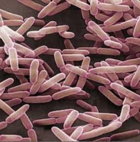 Tuberculose multirésistante: un nouveau traitement bouleverse la donne (étude)