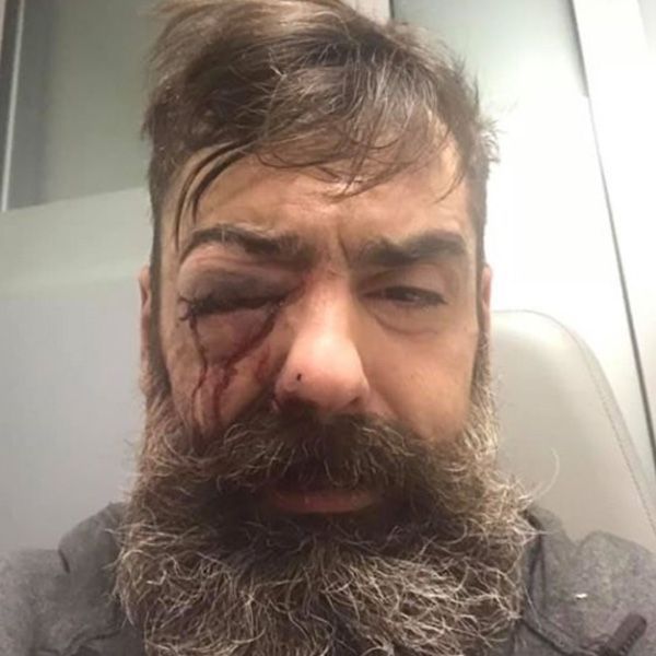 Jérôme Rodrigues, une des figures des "gilets jaunes" blessé à l'œil, l'IGPN saisie
