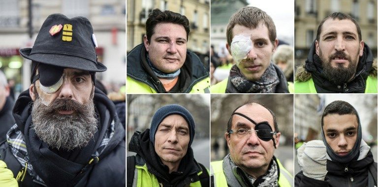 Lettre à Macron : 35 ophtalmologistes de renom dénoncent l’utilisation des LBD par la police
