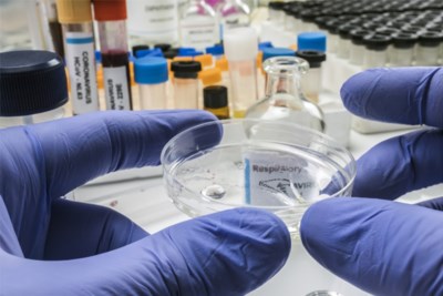 Coronavirus: Début d'un essai clinique européen, la chloroquine inclue