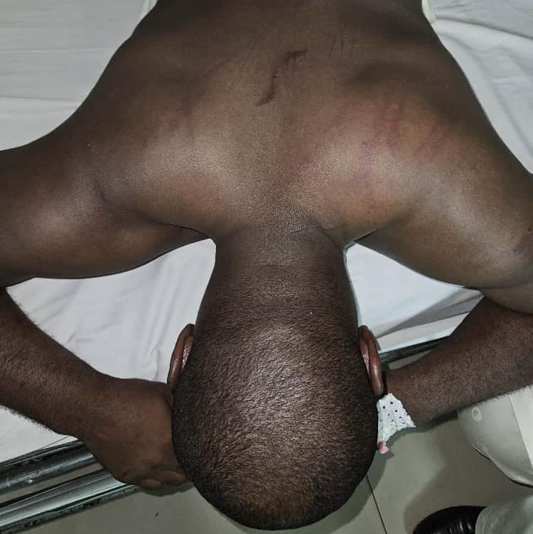 Guy Marius Sagna après son agression à Lomé par des voyous non encore identifiés, le 29 septembre 2024 à Lomé