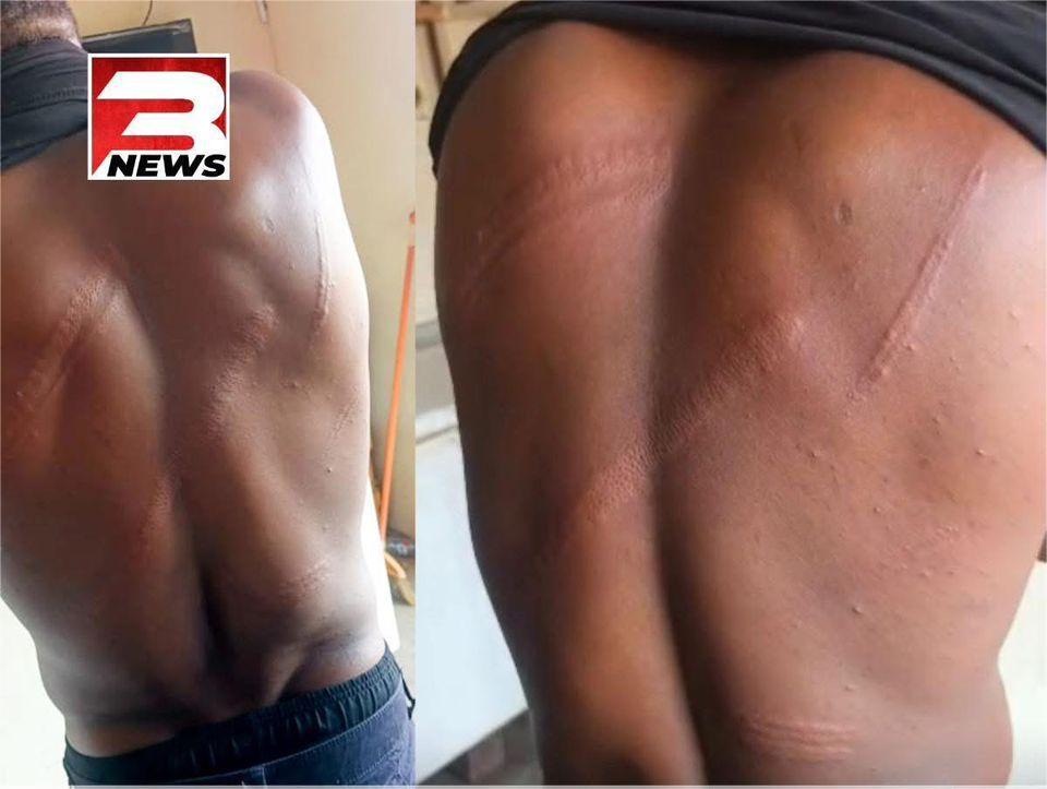 Les signes de l'agression contre le journaliste Salomon Kanaluwe par des officiers militaires ghanéens (Photo News3)