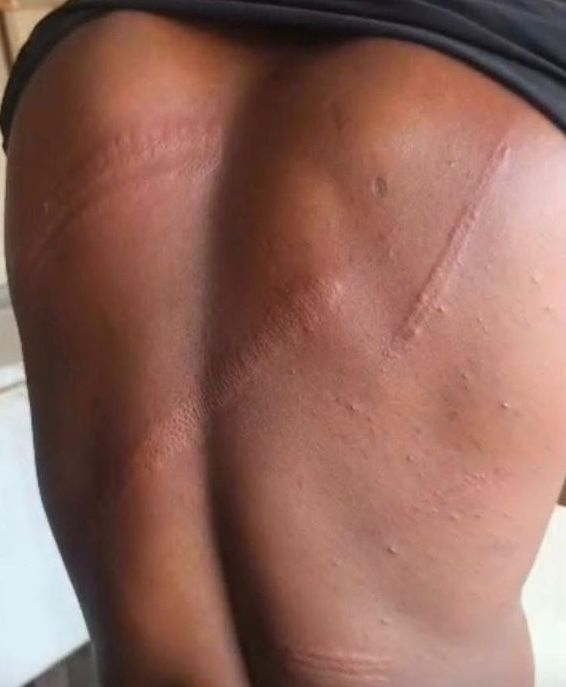 Le journaliste ghanéen Salomon Kanaluwe victime d'agression de la part d'officiers militaires