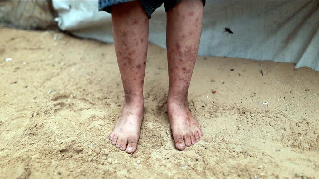 Gaza : faute de pesticides, les camps cèdent aux rats et parasites