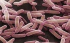 Tuberculose multirésistante: un nouveau traitement bouleverse la donne (étude)