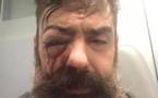 Jérôme Rodrigues, une des figures des "gilets jaunes" blessé à l'œil, l'IGPN saisie