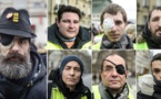 Lettre à Macron : 35 ophtalmologistes de renom dénoncent l’utilisation des LBD par la police