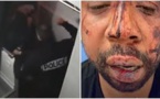 France : 3 policiers suspendus après le tabassage d’un homme noir