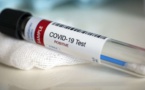 COVID : 2 morts, 733 nouvelles infections