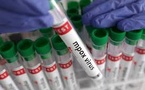 Le nombre de cas de mpox en Afrique dépasse 77.800 et le nombre de morts atteint 1.321 (CDC Afrique)