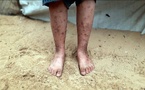 Gaza : faute de pesticides, les camps cèdent aux rats et parasites