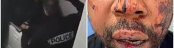 Violences policières en France : Macron «très choqué» par le passage à tabac d’un homme noir