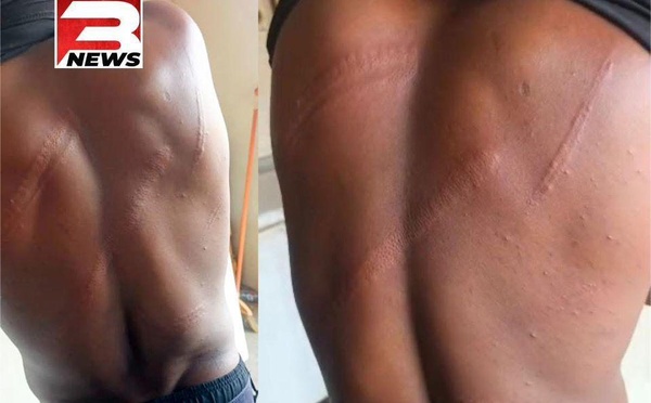 GHANA - L’agression du journaliste Solomon Kanaluwe par des officiers militaires menace la sécurité des journalistes et la liberté de la presse