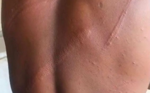 GHANA - Military officers assault of journalist Solomon Kanaluwe threatens safety of journalists and press freedom in Ghana