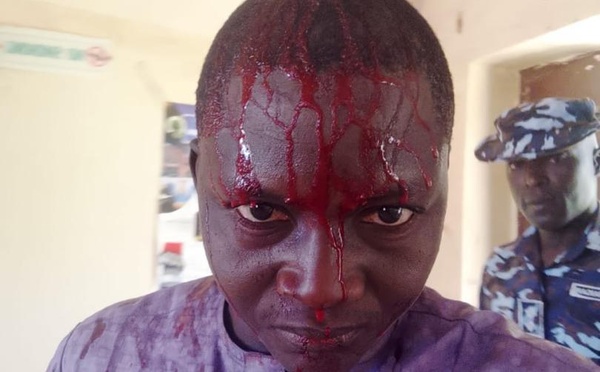 La WAES condamne l'agression sans cause du journaliste nigérian Mohammed Adamu par la police de Bauchi