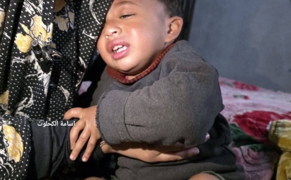 Gaza : quand Israël torture un enfant de 18 mois…