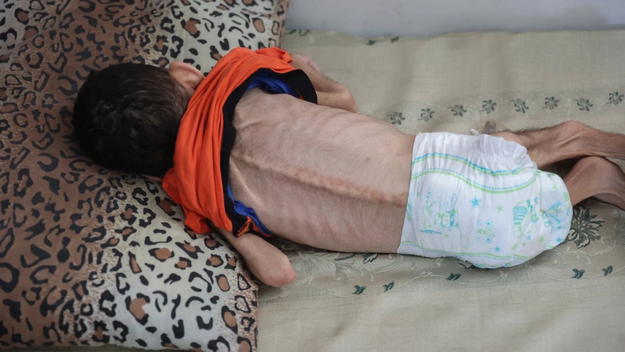 gaza enfant famine gaza enfant famine